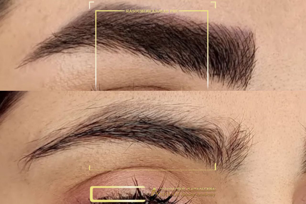 ریمو تاتو ابرو