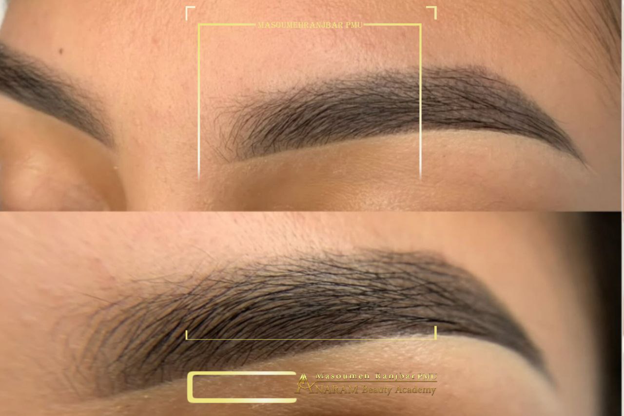 میکروبلیدینگ ابرو