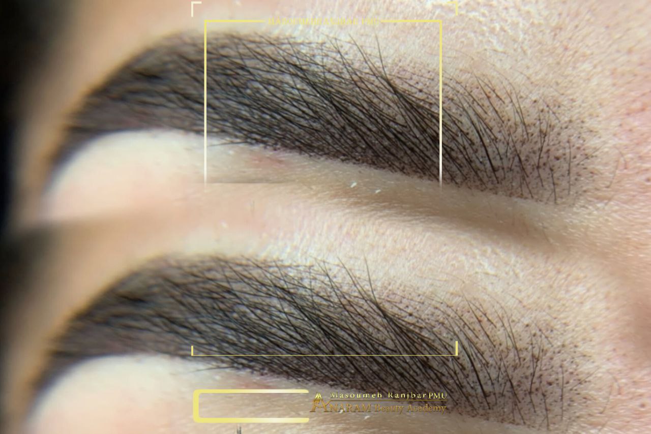 میکروبلیدینگ ابرو