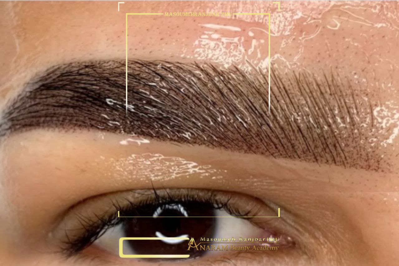 میکروبلیدینگ ابرو