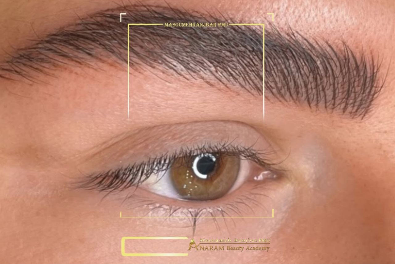 میکروبلیدینگ ابرو