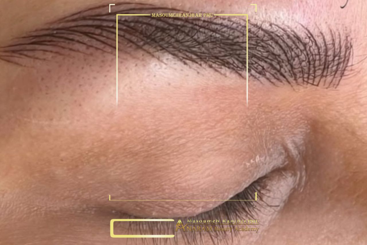 میکروبلیدینگ ابرو