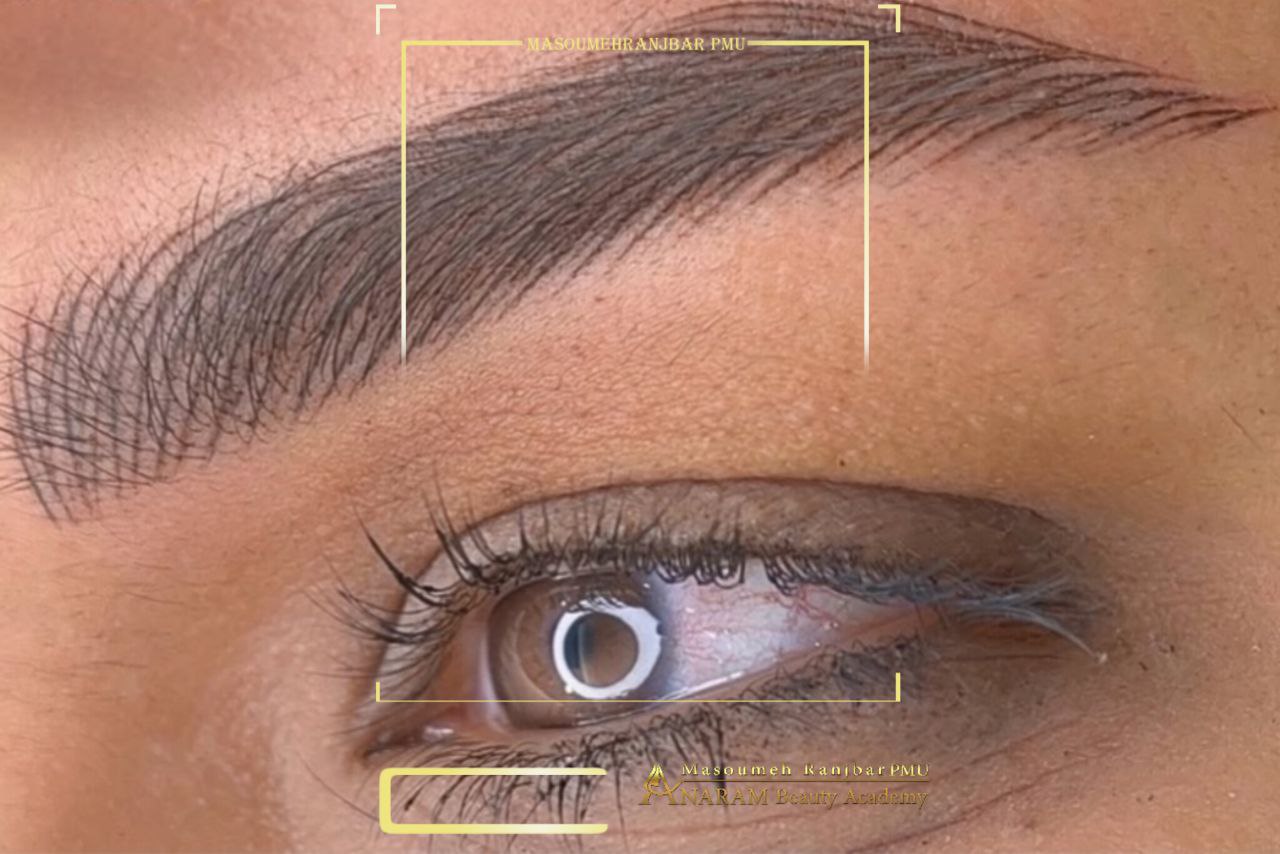 میکروبلیدینگ ابرو